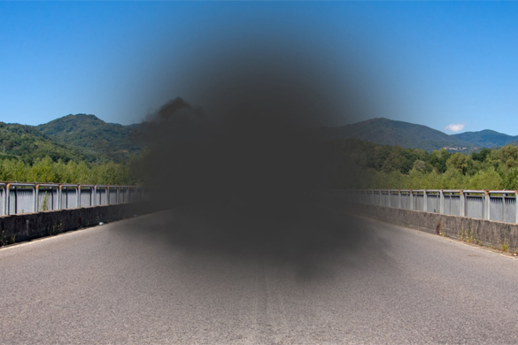 Macular Degeneration Symptoms & Treatment